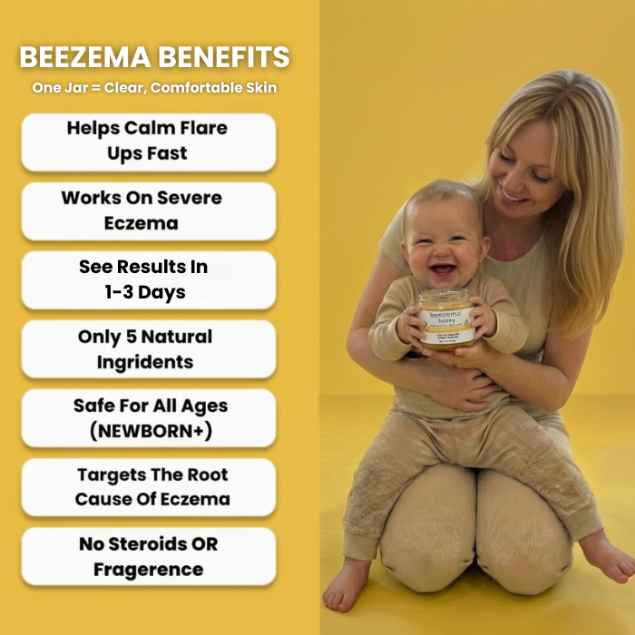 HoneyCalm™ Eczema Cream
