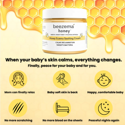 HoneyCalm™ Eczema Cream