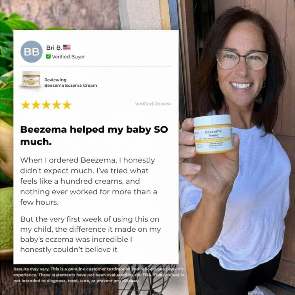 HoneyCalm™ Eczema Cream