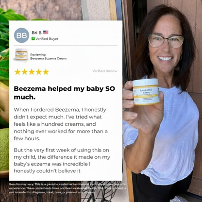 HoneyCalm™ Eczema Cream