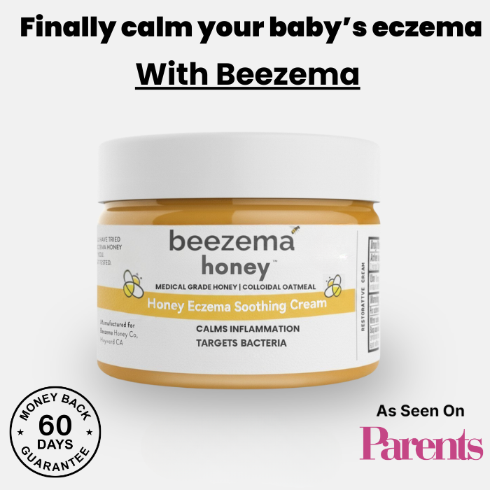 HoneyCalm™ Eczema Cream